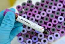 Coronavirus : Un premier cas détecté au Cameroun, le Gabon paré à toute éventualité