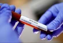 Coronavirus en Afrique centrale : Le bilan au dimanche 22 mars 2020 avec le Cameroun le plus touché, la RDC de plus en plus exposée et une situation stable ailleurs notamment au Gabon