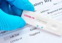 Covid-19 au Gabon : Le point complet sur la situation au mercredi 10 février 2021 avec 6978 tests réalisés (469811 au total), 335 nouveaux cas positifs (12171 au total), 227 nouvelles guérisons (11275 au total) et 0 nouveau décès (71 au total)