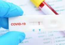 Covid-19 au Gabon : Le point complet sur la situation au vendredi 19 mars 2021 avec 7961 tests réalisés (598479 au total), 414 nouveaux cas positifs (17711 au total), 393 nouvelles guérisons (15495 au total) et 1 nouveau décès (106 au total)