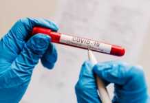 Covid-19 au Gabon : 11 551 tests et 606 cas positifs